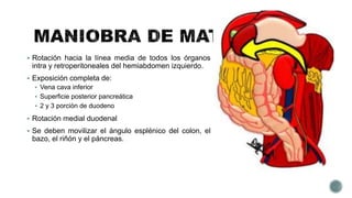  Rotación hacia la línea media de todos los órganos
intra y retroperitoneales del hemiabdomen izquierdo.
 Exposición completa de:
 Vena cava inferior
 Superficie posterior pancreática
 2 y 3 porción de duodeno
 Rotación medial duodenal
 Se deben movilizar el ángulo esplénico del colon, el
bazo, el riñón y el páncreas.
 