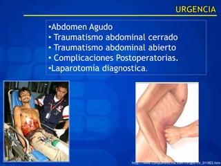 •Abdomen Agudo
• Traumatismo abdominal cerrado
• Traumatismo abdominal abierto
• Complicaciones Postoperatorias.
•Laparotomía diagnostica.




                     http://www.compumedicina.com/cirugia/cir_011003.htm
 