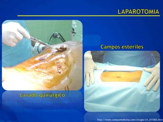http://www.compumedicina.com/cirugia/cir_011003.htm
 