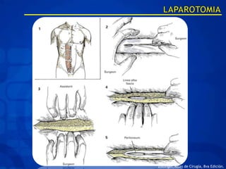 Zollinger, Atlas de Cirugía, 8va Edición.
 