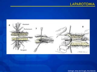 Zollinger, Atlas de Cirugía, 8va Edición.
 