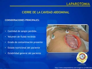 CIERRE DE LA CAVIDAD ABDOMINAL

CONSIDERACIONES PRINCIPALES:



• Cantidad de sangre perdida.

• Volumen de fluido recibido

• Grado de contaminación presente

• Estado nutricional del paciente

• Estabilidad general del paciente




                                     http://www.compumedicina.com/cirugia/cir_011003.htm
 