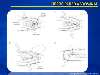 Zollinger, Atlas de Cirugía, 8va Edición.
 