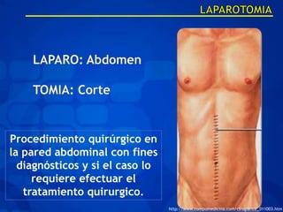 Procedimiento quirúrgico en
la pared abdominal con fines
  diagnósticos y si el caso lo
     requiere efectuar el
   tratamiento quirurgico.
                                 http://www.compumedicina.com/cirugia/cir_011003.htm
 