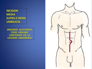 INCISIONINCISION
MEDIAMEDIA
SUPRA E INFRASUPRA E INFRA
UMBILICALUMBILICAL
ORGANOS ACCESADOS :ORGANOS ACCESADOS :
TODO ÓRGANOTODO ÓRGANO
CONTENIDO EN LACONTENIDO EN LA
CAVIDAD ABDOMINALCAVIDAD ABDOMINAL
 