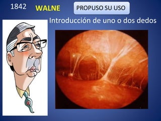 1842 WALNE
Introducción de uno o dos dedos
 
