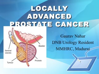 LOCALLYLOCALLY
ADVANCEDADVANCED
PROSTATE CANCERPROSTATE CANCER
Gaurav Nahar
DNB Urology Resident
MMHRC, Madurai
 