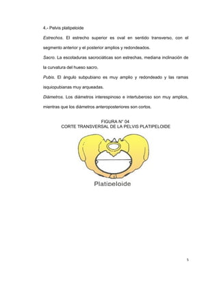 4.- Pelvis platipeloide
Estrechos. El estrecho superior es oval en sentido transverso, con el
segmento anterior y el posterior amplios y redondeados.
Sacro. La escotaduras sacrociáticas son estrechas, mediana inclinación de
la curvatura del hueso sacro.
Pubis. El ángulo subpubiano es muy amplio y redondeado y las ramas
isquiopubianas muy arqueadas.
Diámetros. Los diámetros interespinoso e intertuberoso son muy amplios,
mientras que los diámetros anteroposteriores son cortos.
FIGURA N° 04
CORTE TRANSVERSAL DE LA PELVIS PLATIPELOIDE
5
 