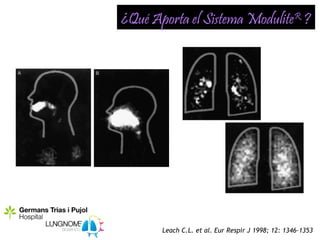 ¿Qué Aporta el Sistema ModuliteR ?




       Leach C.L. et al. Eur Respir J 1998; 12: 1346–1353
 