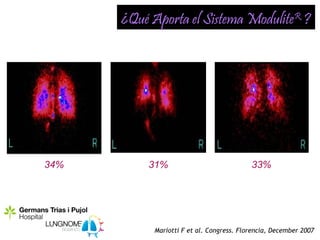 ¿Qué Aporta el Sistema ModuliteR ?




34%       31%                             33%




           Mariotti F et al. Congress. Florencia, December 2007
 