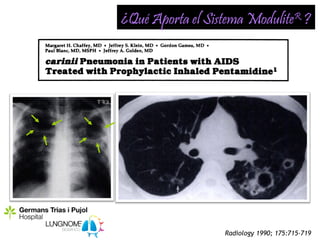 ¿Qué Aporta el Sistema ModuliteR ?




                  Radiology 1990; 175:715-719
 