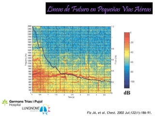 Líneas de Futuro en Pequeñas Vías Aéreas




               Fiz JA, et al. Chest. 2002 Jul;122(1):186-91.
 