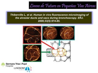 Líneas de Futuro en Pequeñas Vías Aéreas
Thiberville L, et al. Human in vivo fluorescence microimaging of
    the alveolar ducts and sacs during bronchoscopy. ERJ.
                        2009;33(5):974-85.
 