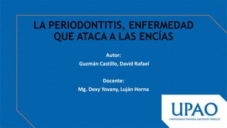 LA PERIODONTITIS, ENFERMEDAD
QUE ATACA A LAS ENCÍAS
Autor:
Guzmán Castillo, David Rafael
Docente:
Mg. Dexy Yovany, Luján Horna
 