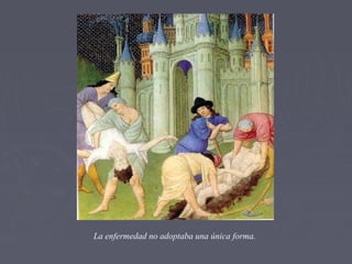 La enfermedad no adoptaba una única forma.
 