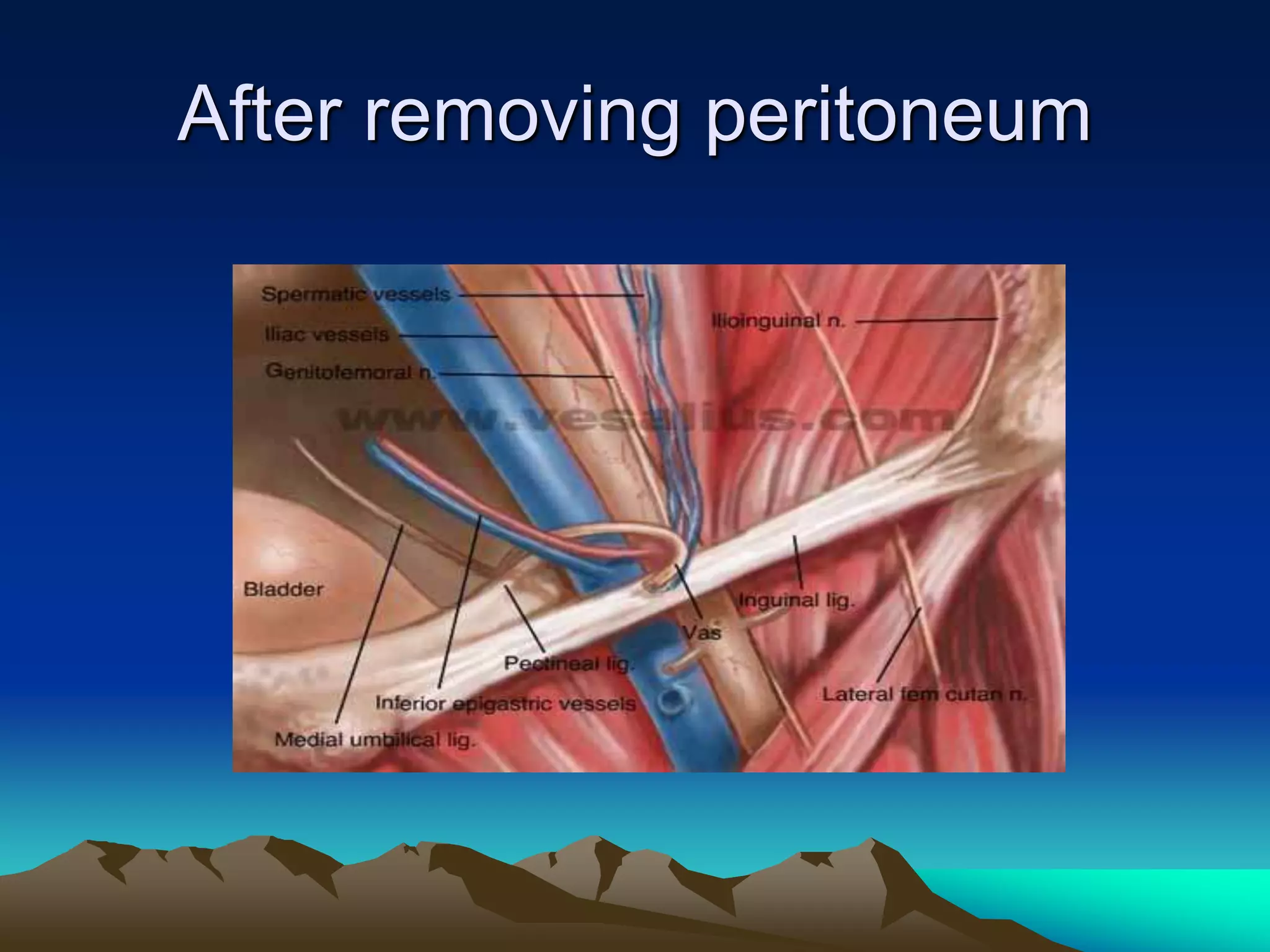 After removing peritoneum
 