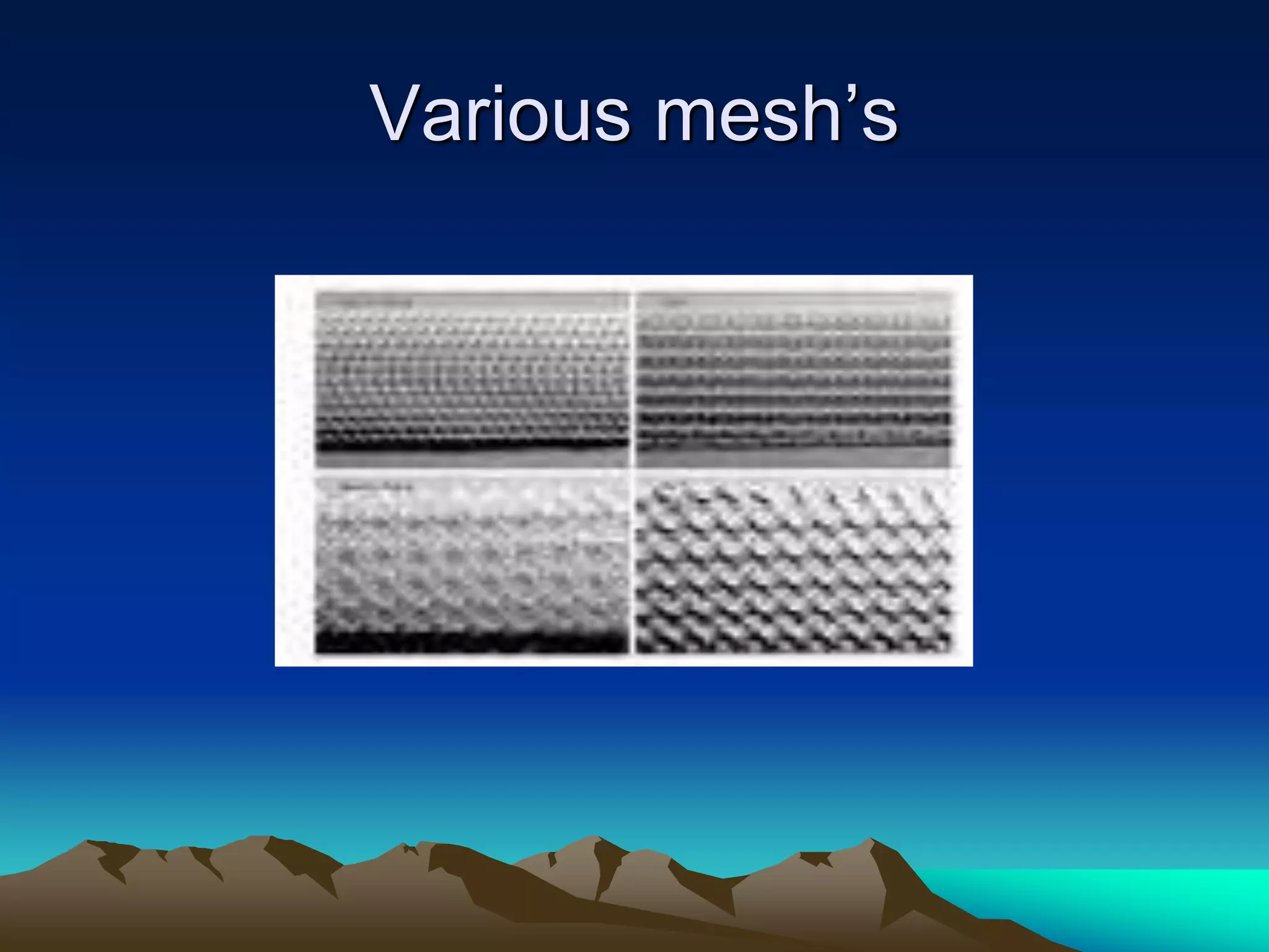 Various mesh’s
 