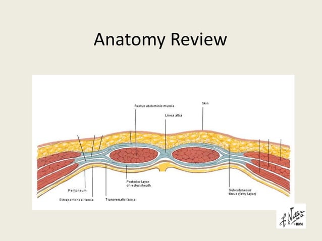 Laparoscopic Inguinal Hernia Repair Anatomy – XGDM