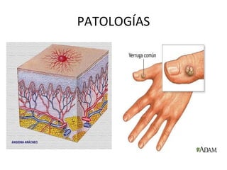 PATOLOGÍAS 