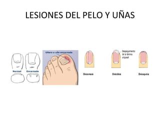 LESIONES DEL PELO Y UÑAS 