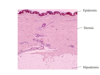 Epidermis
Dermis
Hipodermis
 