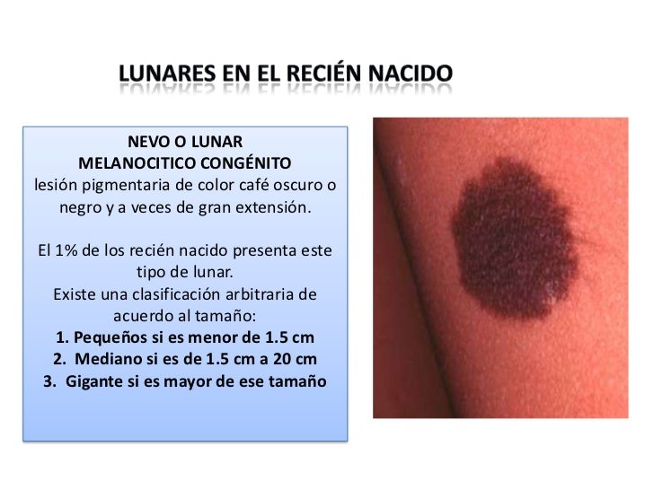 Las pecas, nuevas la aventura, y kipyatoshi