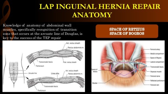 Inguinal Hernia Surgical Anatomy