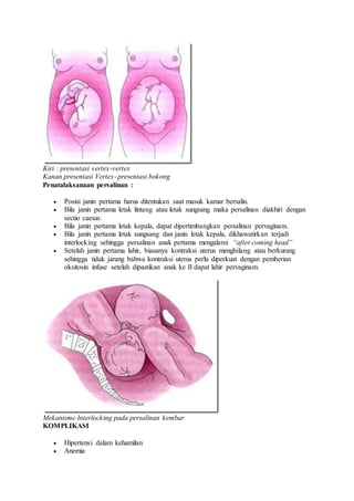 Kiri : presentasi vertex-vertex
Kanan presentasi Vertex- presentasi bokong
Penatalaksanaan persalinan :
 Posisi janin pertama harus ditentukan saat masuk kamar bersalin.
 Bila janin pertama letak lintang atau letak sungsang maka persalinan diakhiri dengan
sectio caesar.
 Bila janin pertama letak kepala, dapat dipertimbangkan persalinan pervaginam.
 Bila janin pertama letak sungsang dan janin letak kepala, dikhawatirkan terjadi
interlocking sehingga persalinan anak pertama mengalami “after coming head”
 Setelah janin pertama lahir, biasanya kontraksi uterus menghilang atau berkurang
sehingga tidak jarang bahwa kontraksi uterus perlu diperkuat dengan pemberian
oksitosin infuse setelah dipastikan anak ke II dapat lahir pervaginam.
Mekanisme Interlocking pada persalinan kembar
KOMPLIKASI
 Hipertensi dalam kehamilan
 Anemia
 