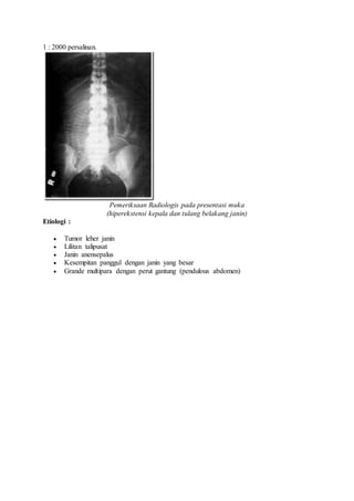 1 : 2000 persalinan.
Pemeriksaan Radiologis pada presentasi muka
(hiperekstensi kepala dan tulang belakang janin)
Etiologi :
 Tumor leher janin
 Lilitan talipusat
 Janin anensepalus
 Kesempitan panggul dengan janin yang besar
 Grande multipara dengan perut gantung (pendulous abdomen)
 
