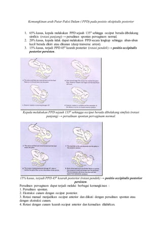 Kemungkinan arah Putar Paksi Dalam ( PPD) pada posisio oksipitalis posterior
1. 65% kasus, kepala melakukan PPD sejauh 1350 sehingga occiput berada dibelakang
simfisis (rotasi panjang) → persalinan spontan pervaginam normal.
2. 20% kasus, kepala tidak dapat melakukan PPD secara lengkap sehingga ubun-ubun
kecil berada dikiri atau dikanan (deep tranverse arrest).
3. 15% kasus, terjadi PPD 450 kearah posterior (rotasi pendek) → positio occipitalis
posterior persisten.
Kepala melakukan PPD sejauh 1350 sehingga occiput berada dibelakang simfisis (rotasi
panjang) → persalinan spontan pervaginam normal.
15% kasus, terjadi PPD 450 kearah posterior (rotasi pendek) → positio occipitalis posterior
persisten.
Persalinan pervaginam dapat terjadi melalui berbagai kemungkinan :
1. Persalinan spontan.
2. Ekstraksi cunam dengan occiput posterior.
3. Rotasi manual menjadikan occiput anterior dan diikuti dengan persalinan spontan atau
dengan ekstraksi cunam.
4. Rotasi dengan cunam kearah occiput anterior dan kemudian dilahirkan.
 