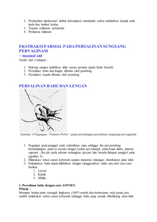 2. Perdarahan intrakranial akibat dekompresi mendadak waktu melahirkan kepala anak
pada fase lambat kedua.
3. Trauma collumna vertebralis.
4. Prolapsus talipusat.
EKSTRAKSIPARSIAL PADAPERSALINAN SUNGSANG
PERVAGINAM
= manual aid
Terdiri dari 3 tahapan :
1. Bokong sampai umbilikus lahir secara spontan (pada frank breech).
2. Persalinan bahu dan lengan dibantu oleh penolong.
3. Persalinan kepala dibantu oleh penolong.
PERSALINAN BAHUDAN LENGAN
Gambar 3 Pegangan “Femuro Pelvic” pada pertolongan persalinan sungsang pervaginam
1. Pegangan pada panggul anak sedemikian rupa sehingga ibu jari penolong
berdampingan pada os sacrum dengan kedua jari telunjuk pada krista iliaka anterior
superior ; ibu jari pada sakrum sedangkan jari-jari lain berada didepan pangkal paha
(gambar 3) .
2. Dilakukan traksi curam kebawah sampai menemui rintangan (hambatan) jalan lahir.
3. Selanjutnya bahu dapat dilahirkan dengan menggunakan salah satu dari cara-cara
berikut:
1. Lovset.
2. Klasik.
3. Müller.
1. Persalinan bahu dengan cara LOVSET.
Prinsip :
Memutar badan janin setengah lingkaran (1800) searah dan berlawanan arah jarum jam
sambil melakukan traksi curam kebawah sehingga bahu yang semula dibelakang akan lahir
 