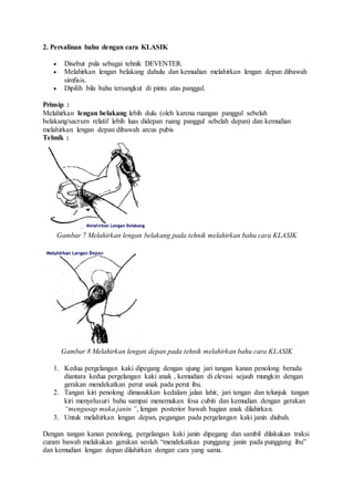 2. Persalinan bahu dengan cara KLASIK
 Disebut pula sebagai tehnik DEVENTER.
 Melahirkan lengan belakang dahulu dan kemudian melahirkan lengan depan dibawah
simfisis.
 Dipilih bila bahu tersangkut di pintu atas panggul.
Prinsip :
Melahirkan lengan belakang lebih dulu (oleh karena ruangan panggul sebelah
belakang/sacrum relatif lebih luas didepan ruang panggul sebelah depan) dan kemudian
melahirkan lengan depan dibawah arcus pubis
Tehnik :
Gambar 7 Melahirkan lengan belakang pada tehnik melahirkan bahu cara KLASIK
Gambar 8 Melahirkan lengan depan pada tehnik melahirkan bahu cara KLASIK
1. Kedua pergelangan kaki dipegang dengan ujung jari tangan kanan penolong berada
diantara kedua pergelangan kaki anak , kemudian di elevasi sejauh mungkin dengan
gerakan mendekatkan perut anak pada perut ibu.
2. Tangan kiri penolong dimasukkan kedalam jalan lahir, jari tengan dan telunjuk tangan
kiri menyelusuri bahu sampai menemukan fosa cubiti dan kemudian dengan gerakan
“mengusap muka janin ”, lengan posterior bawah bagian anak dilahirkan.
3. Untuk melahirkan lengan depan, pegangan pada pergelangan kaki janin diubah.
Dengan tangan kanan penolong, pergelangan kaki janin dipegang dan sambil dilakukan traksi
curam bawah melakukan gerakan seolah “mendekatkan punggung janin pada punggung ibu”
dan kemudian lengan depan dilahirkan dengan cara yang sama.
 