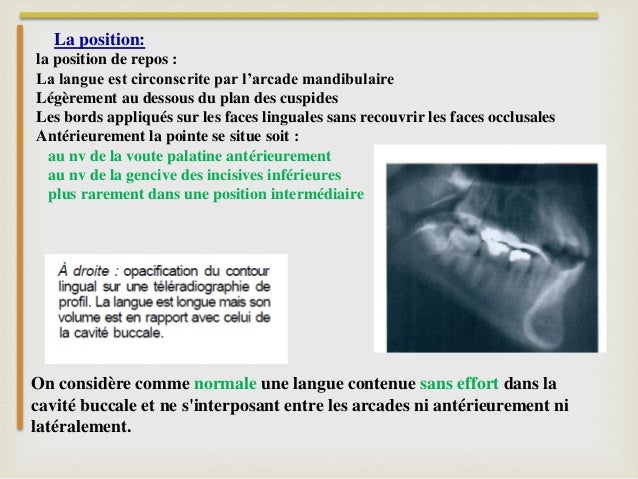 La place de la langue en odf
