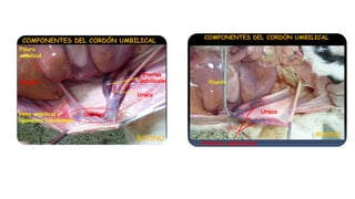 Generalidades La placenta y tipos de placenta.pdf