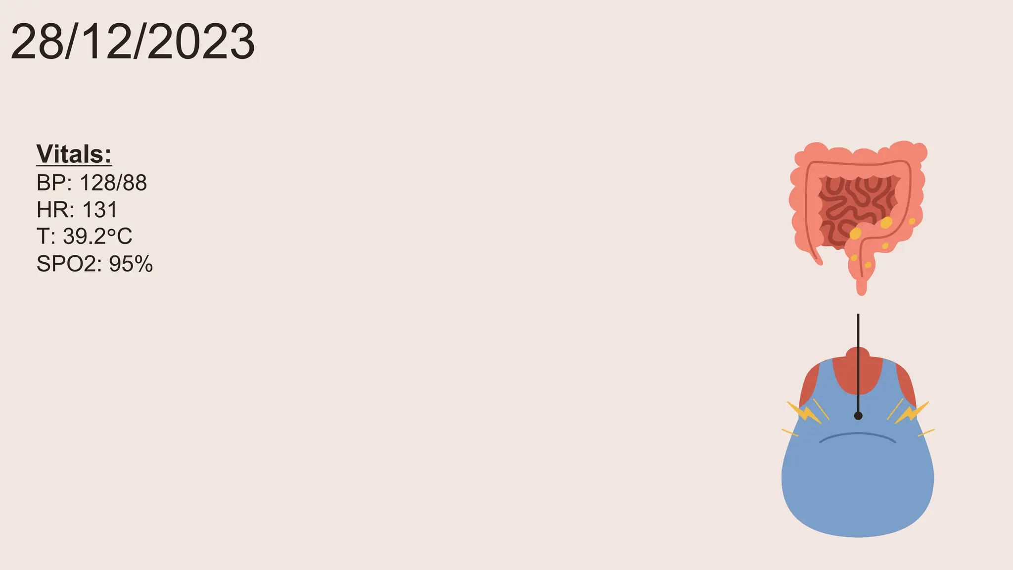 28/12/2023
Vitals:
BP: 128/88
HR: 131
T: 39.2°C
SPO2: 95%
 
