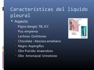 Características del liquido
pleural
 Aspecto
 Pajizo (beige): TB, ICC
 Pus: empiema
 Lechoso: Quilotorax
 Chocolate : Absceso amebiano
 Negro: Aspergillus
 Olor Putrido: Anaerobios
 Olor Amoniacal: Urinotorax
 