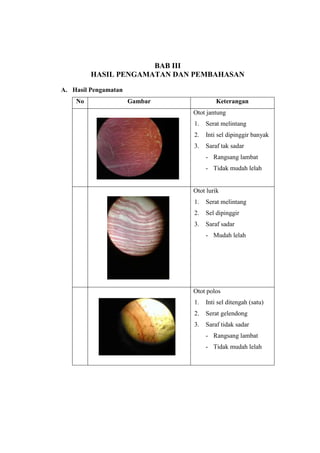 BAB III
         HASIL PENGAMATAN DAN PEMBAHASAN

A. Hasil Pengamatan
    No                Gambar            Keterangan
                               Otot jantung
                               1.   Serat melintang
                               2.   Inti sel dipinggir banyak
                               3.   Saraf tak sadar
                                    - Rangsang lambat
                                    - Tidak mudah lelah


                               Otot lurik
                               1.   Serat melintang
                               2.   Sel dipinggir
                               3.   Saraf sadar
                                    - Mudah lelah




                               Otot polos
                               1.   Inti sel ditengah (satu)
                               2.   Serat gelendong
                               3.   Saraf tidak sadar
                                    - Rangsang lambat
                                    - Tidak mudah lelah
 