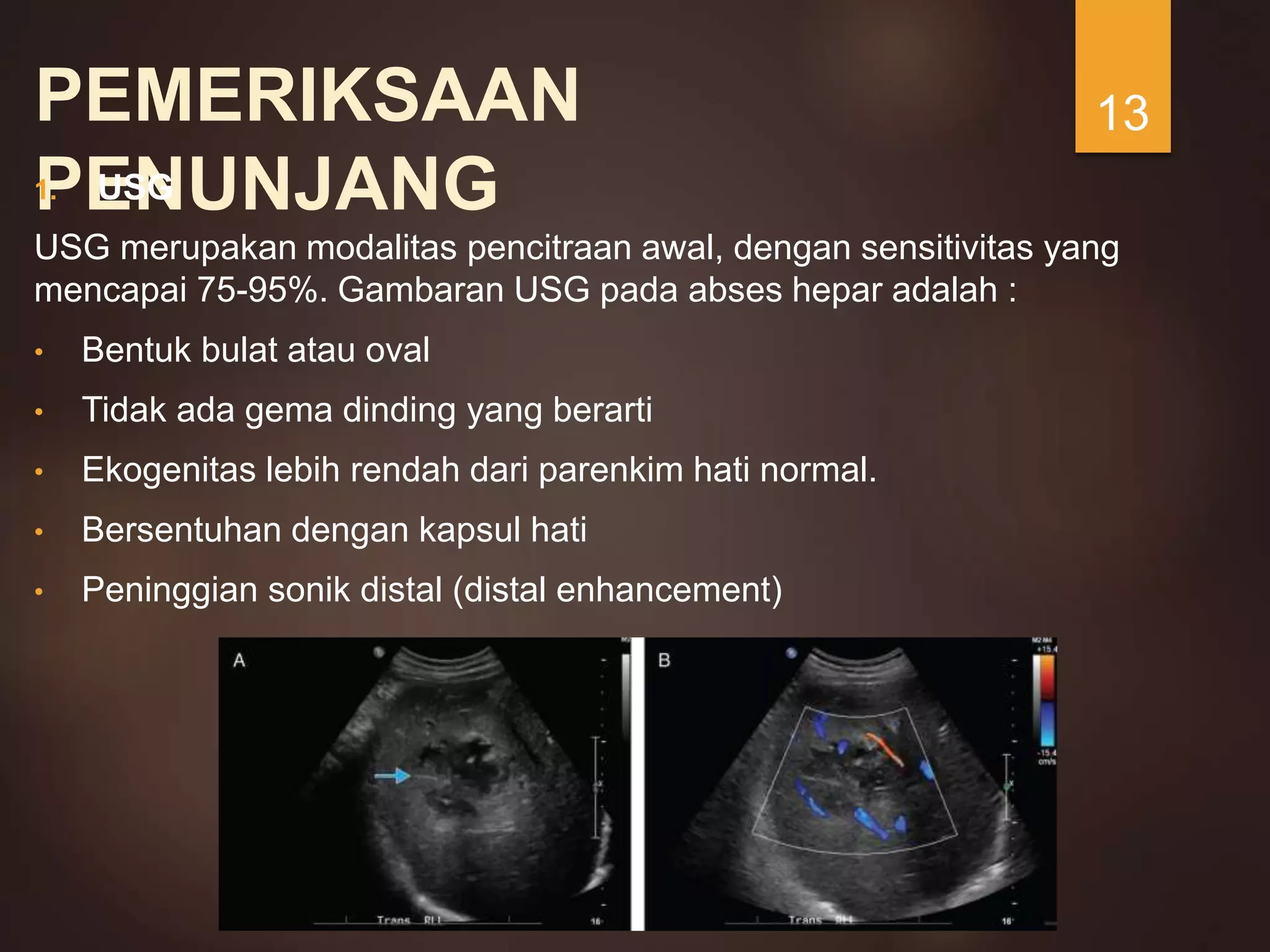 Laporan Kasus Abses Hepardr.pptx