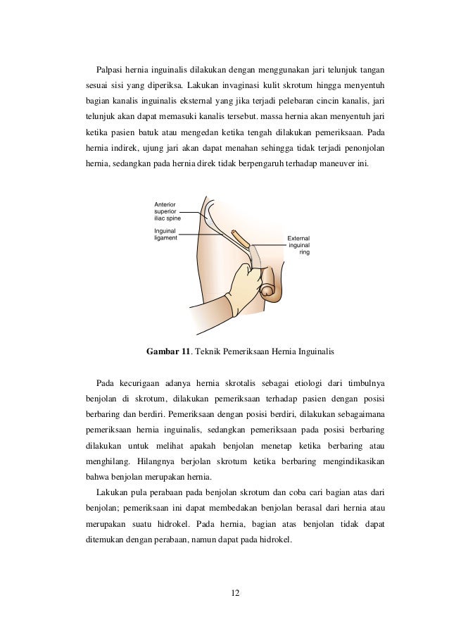 Laporan Kasus Bedah Anak Hernia Inguinalis Lateralis 