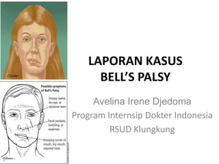 LAPORAN KASUS
BELL’S PALSY
Avelina Irene Djedoma
Program Internsip Dokter Indonesia
RSUD Klungkung
 