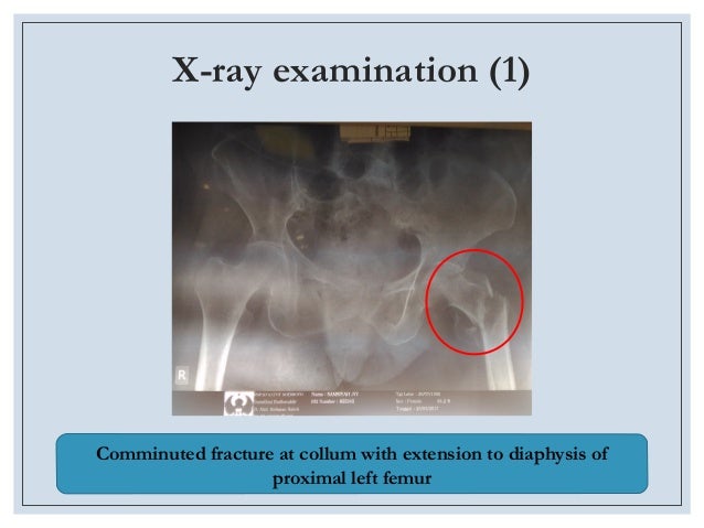 Laporan Kasus Cardiac Assessment In Non Cardiac Surgery Sabrina Erri