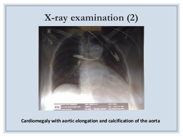 Laporan Kasus Cardiac Assessment In Non Cardiac Surgery Sabrina Erri