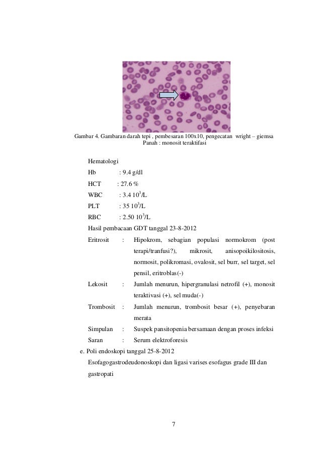 Laporan kasus encelopati hepatikum/dr Diana Arwati