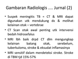 Gambaran Radiologis .... Jurnal (2)
• Suspek meningitis TB = CT & MRI dapat
digunakan utk mendukung dx & melihat
kelainan otak – vertebrae
• CT Scan otak awal penting utk intervensi
bedah hidrosefalus
• MRI lbh baik drpd CT dlm mengungkap
kelainan batang otak, serebelum,
tuberkuloma, stroke & eksudat inflamasinya
• MRI sensitif dalam mendeteksi stroke. Stroke
di TBM tjd 15%-57%
 