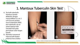 Laporan_Kasus_TB_Laten_Komorbid_HIV[1].pptx