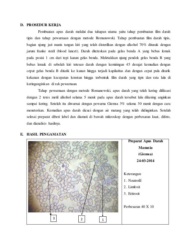 Laporan Praktikum Apus Darah Laboratorium Biologi Unnes
