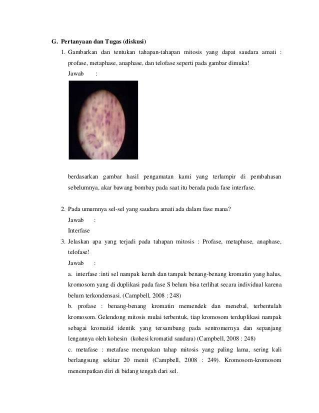 Laporan praktikum mitosis akar Allium cepa Laporan praktikum mitosis akar Allium cepa