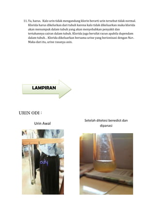 11. Ya, harus. Kalo urin tidak mengandung klorin berarti urin tersebut tidak normal.
Klorida harus dikelurkan dari tubuh karena kalo tidak dikeluarkan maka klorida
akan menumpuk dalam tubuh yang akan menyebabkan penyakit dan
tertahannya cairan dalam tubuh. Klorida juga bersifat racun apabila dupendam
dalam tubuh. . Klorida dikeluarkan bersama urine yang berionisasi dengan Na+.
Maka dari itu, urine rasanya asin.
URIN ODI :
Urin Awal
Setelah ditetesi benedict dan
dipanasi
LAMPIRAN
 