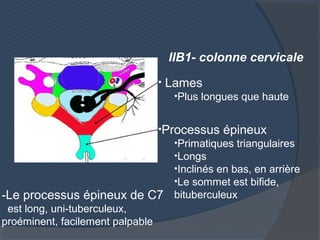 IIB1- colonne cervicale
• Lames
•Plus longues que haute
•Processus épineux
•Primatiques triangulaires
•Longs
•Inclinés en ...