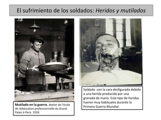 El sufrimiento de los soldados: Heridos y mutilados
Mutilado en la guerra. Atelier de l'école
de rééducation professionnelle du Grand
Palais à Paris. 1918.
Soldado con la cara desfigurada debido
a una herida producida por una
granada de mano. Este tipo de heridas
fueron muy habituales durante la
Primera Guerra Mundial.
 